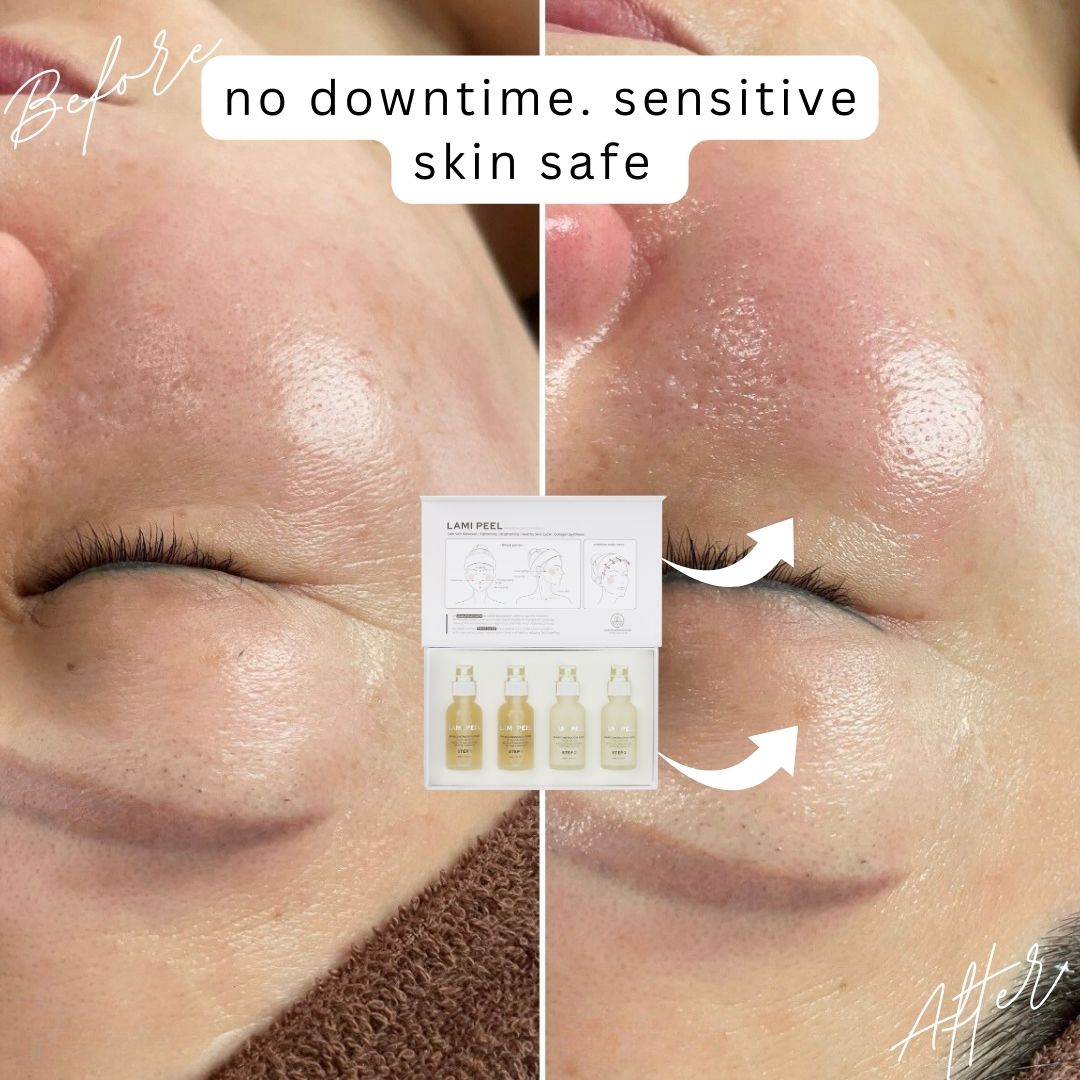 Japanese Lami-Peel Facial